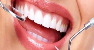 أحصلي على ابتسامة هوليود بوصفات طبيعية