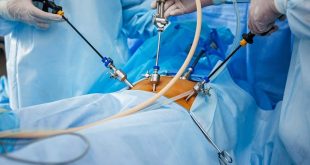 استشاري مناظير وجراحة يكشف الوقت المناسب لاجراء جراحات السمنة