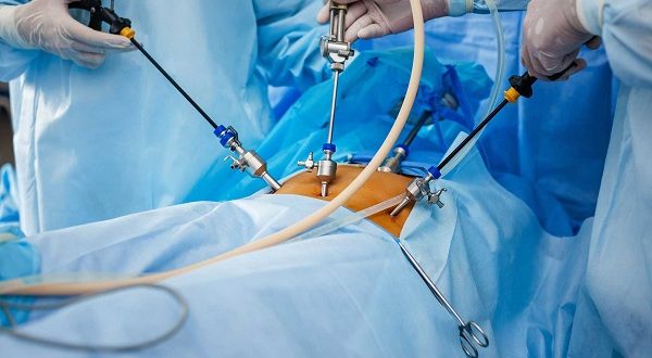 استشاري مناظير وجراحة يكشف الوقت المناسب لاجراء جراحات السمنة