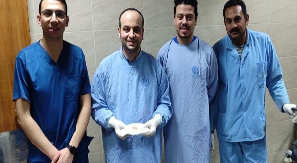 فريق طبى بجامعة المنصورة ينجح فى استخراج عظام تسببت في انسداد المرئ