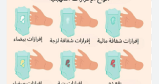 الافرازات المهبلية اسبابها ومتى يجب مراجعة الطبيب المختص؟