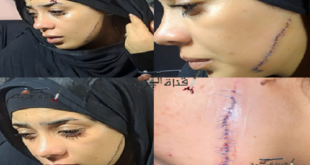 سيدة تشوه وجه عروس طليقها وتتفاخر عبر وسائل التواصل الإجتماعي