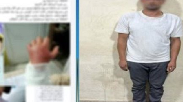 "غضب أعمى يحيل طفلة إلى المستشفى... أب يعذب ابنته حتى النزيف في كفر الشيخ"