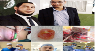 فريق جراحة القلب المفتوح بمستشفى الحسين الجامعي (طب الأزهر) ينجح في إنقاذ حياة شاب باستئصال ورم نادر جدا من القلب بتقنية عالية الدقة (التدخل المحدود).