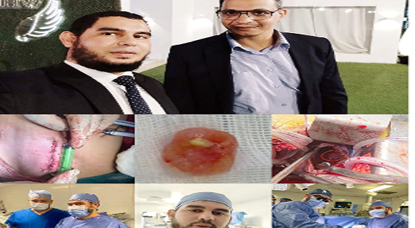 فريق جراحة القلب المفتوح بمستشفى الحسين الجامعي (طب الأزهر) ينجح في إنقاذ حياة شاب باستئصال ورم نادر جدا من القلب بتقنية عالية الدقة (التدخل المحدود).