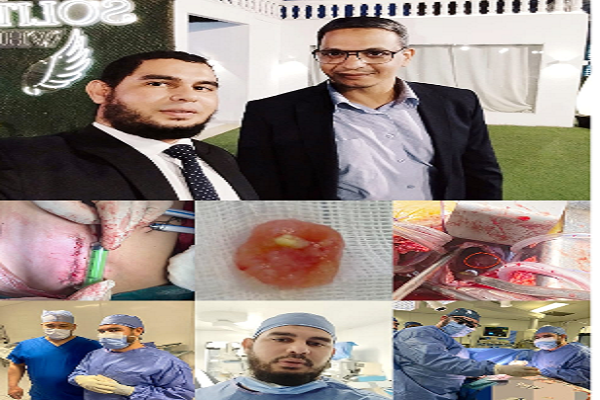 فريق جراحة القلب المفتوح بمستشفى الحسين الجامعي (طب الأزهر) ينجح في إنقاذ حياة شاب باستئصال ورم نادر جدا من القلب بتقنية عالية الدقة (التدخل المحدود).